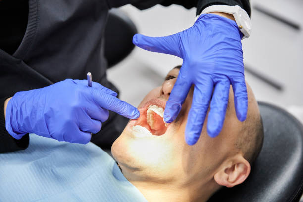 Best Chipped Tooth Repair Near Me  in Powderly, TX