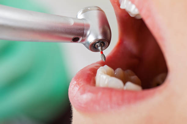 Best Emergency Dentist Near Me  in Powderly, TX